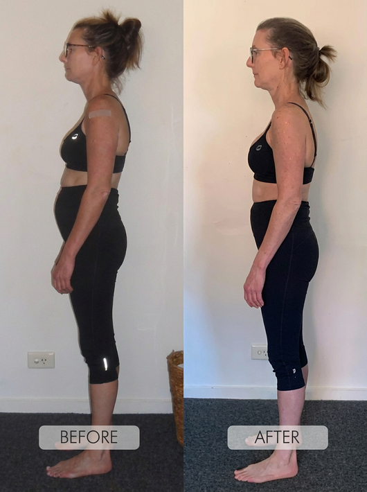 Instant Posture Corrector